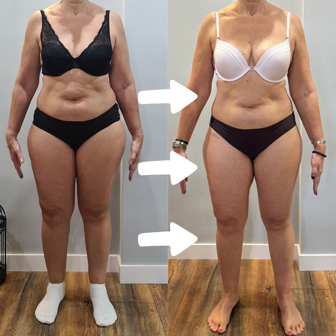 Transformación alumna TMV