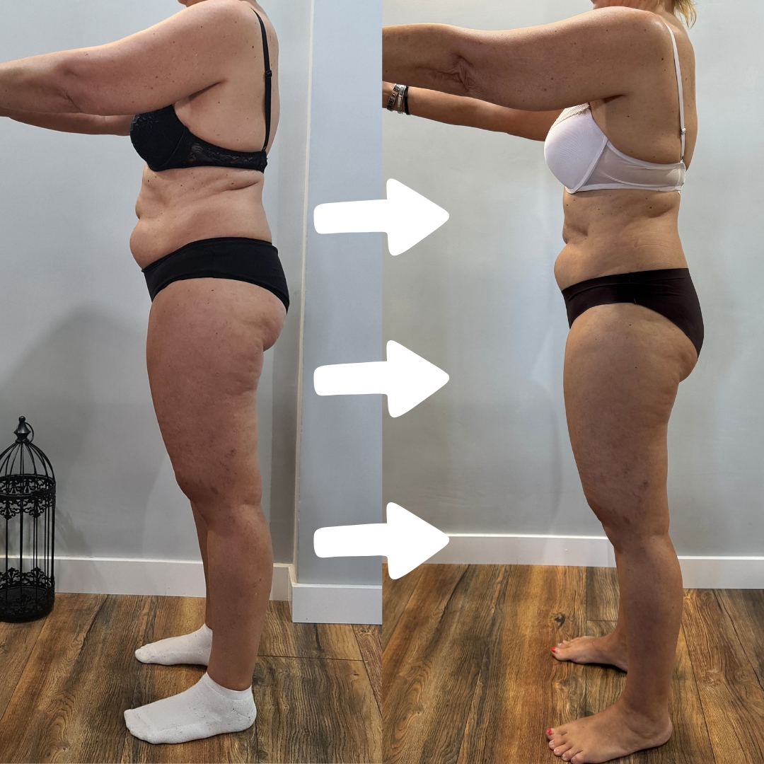 Transformación alumna TMV