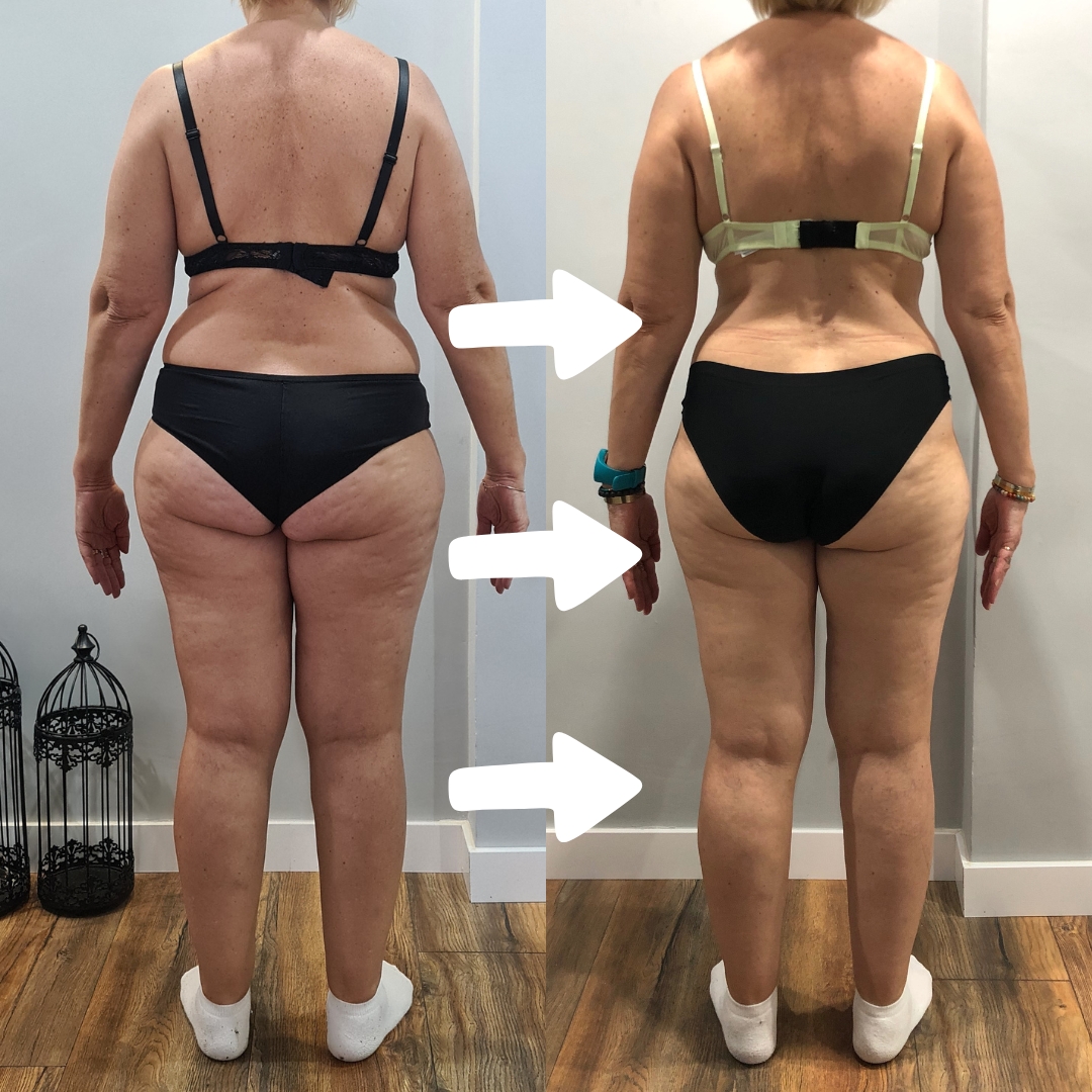 Transformación alumna TMV