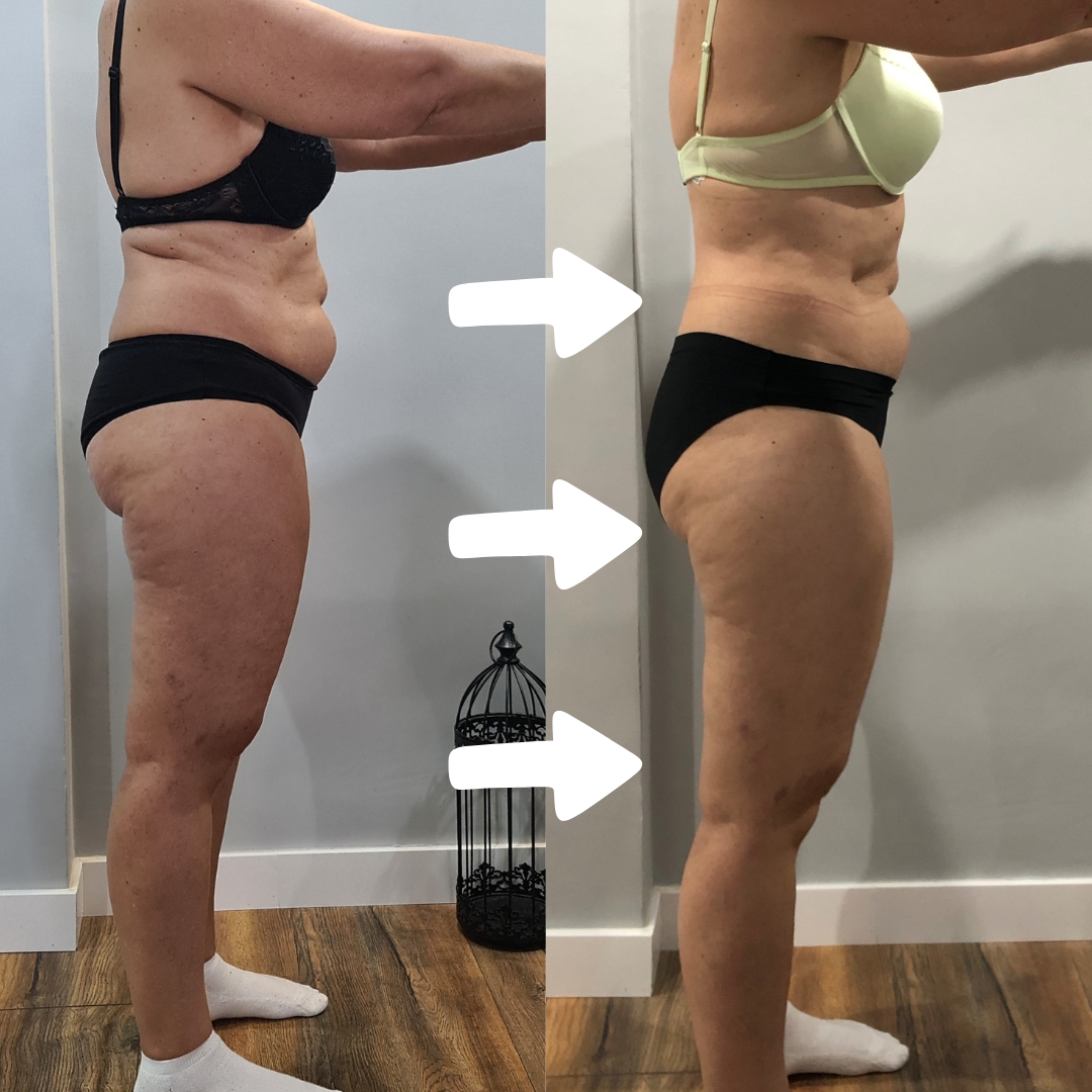 Transformación alumna TMV